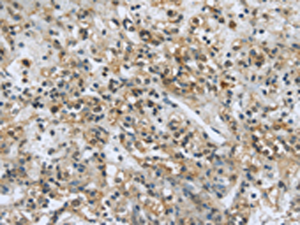 Rabbit Polyclonal Antibody to USP28