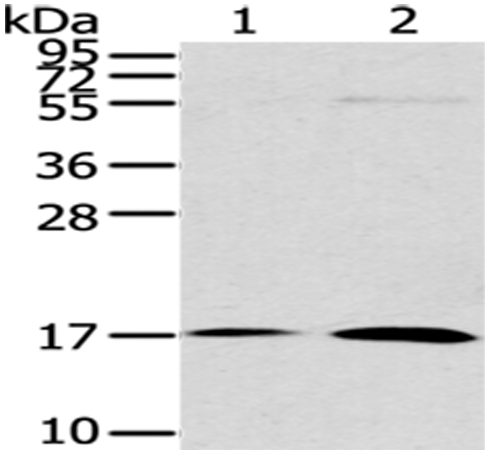 Rabbit Polyclonal Antibody to UTS2B
