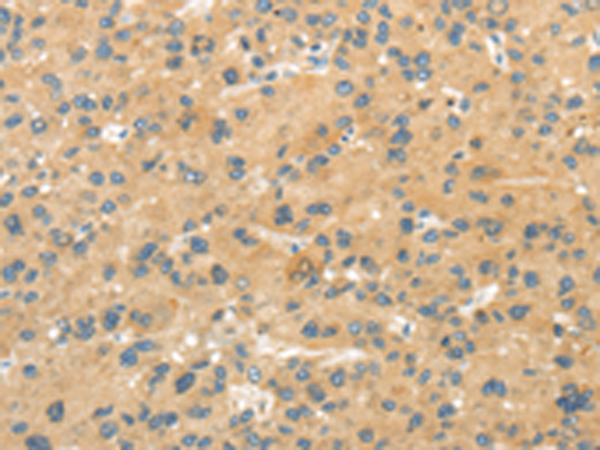 Rabbit Polyclonal Antibody to MPP6