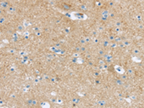 Rabbit Polyclonal Antibody to VAMP1