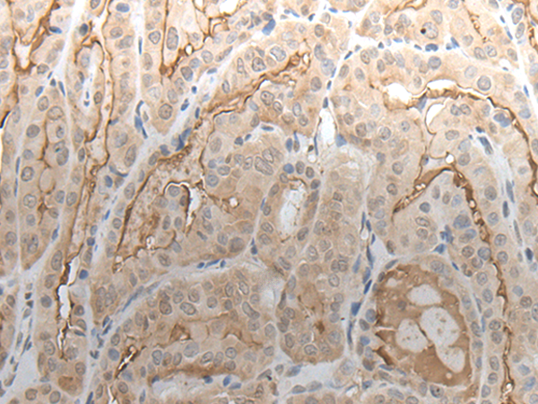 Rabbit Polyclonal Antibody to VAV3