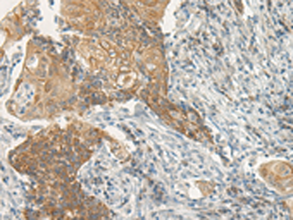 Rabbit Polyclonal Antibody to VIPR2