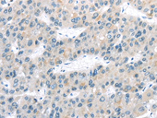 Rabbit Polyclonal Antibody to VLDLR