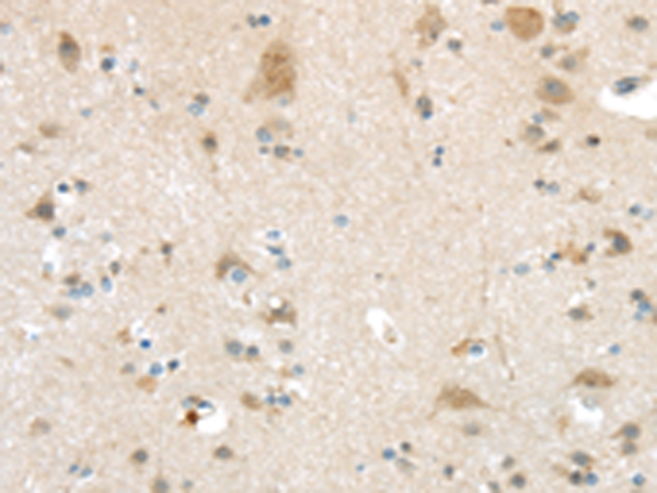 Rabbit Polyclonal Antibody to VSIG10