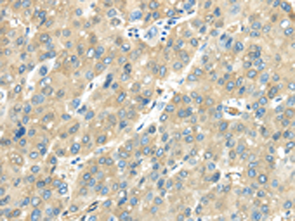 Rabbit Polyclonal Antibody to VPS4A