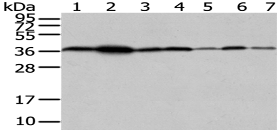 Rabbit Polyclonal Antibody to VPS26A