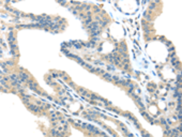 Rabbit Polyclonal Antibody to VPS36