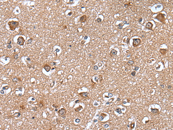 Rabbit Polyclonal Antibody to WAPL