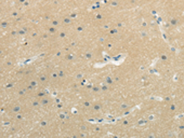 Rabbit Polyclonal Antibody to WASF3