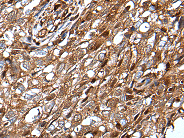 Rabbit Polyclonal Antibody to MLXIPL