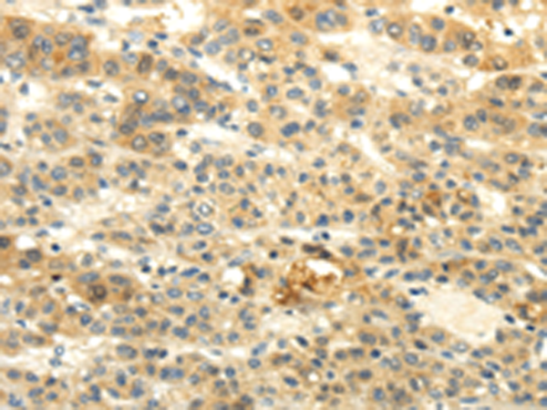 Rabbit Polyclonal Antibody to BRWD1