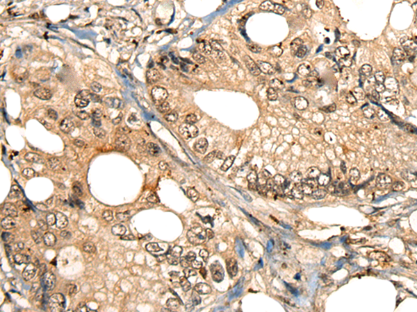 Rabbit Polyclonal Antibody to THOC6