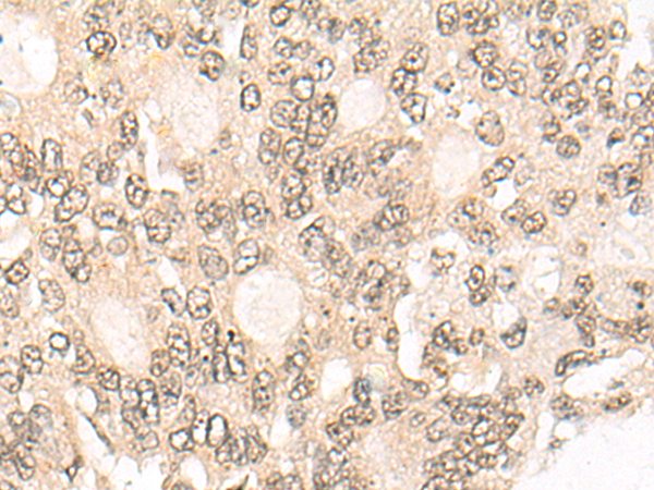 Rabbit Polyclonal Antibody to WEE1