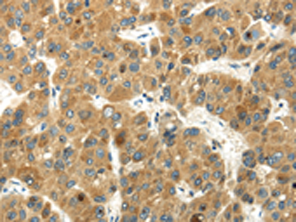 Rabbit Polyclonal Antibody to WFDC1