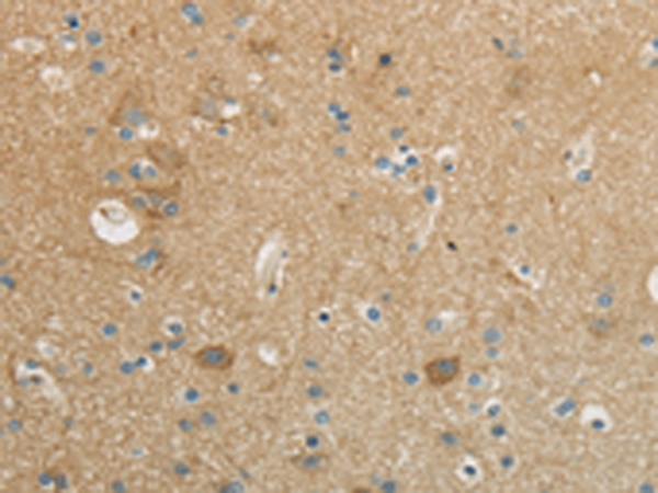 Rabbit Polyclonal Antibody to CCN4