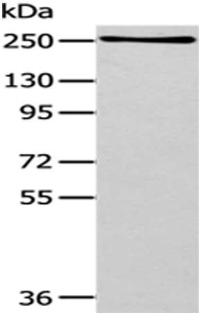 Rabbit Polyclonal Antibody to WNK1