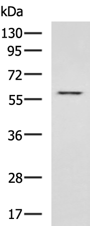 Rabbit Polyclonal Antibody to ENTPD1