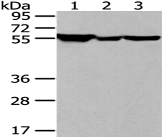 Rabbit Polyclonal Antibody to FYN