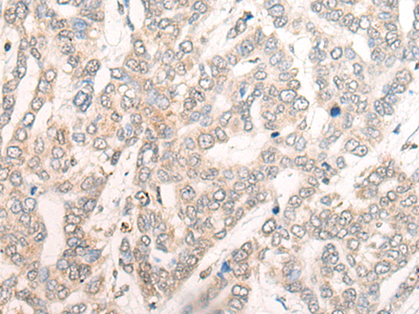 Rabbit Polyclonal Antibody to IL6ST