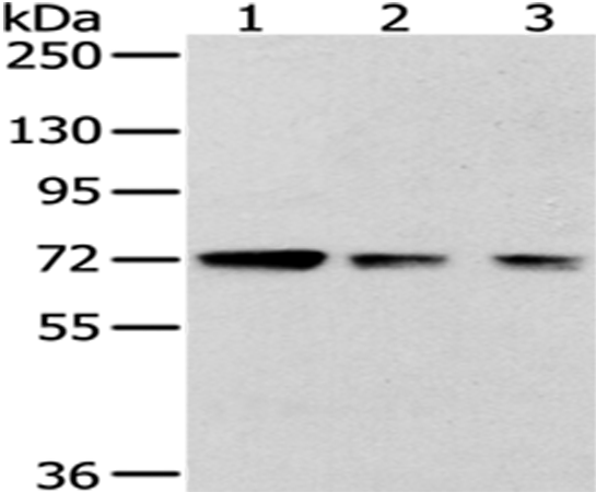 Rabbit Polyclonal Antibody to HNRNPM