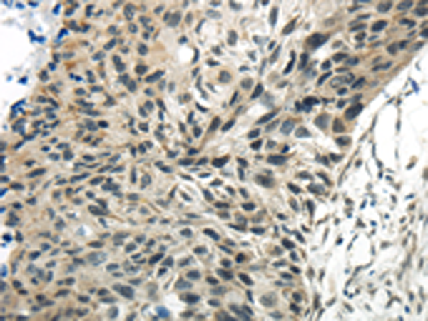 Rabbit Polyclonal Antibody to SYNCRIP