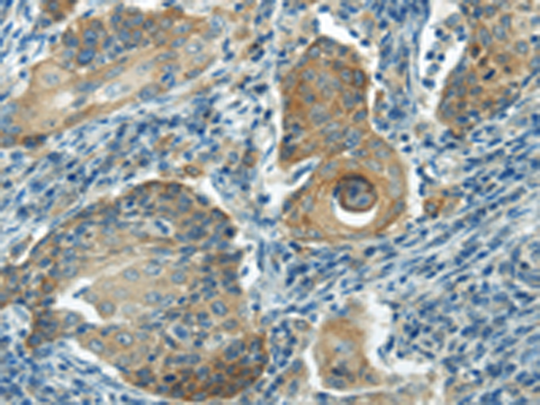 Rabbit Polyclonal Antibody to IL20