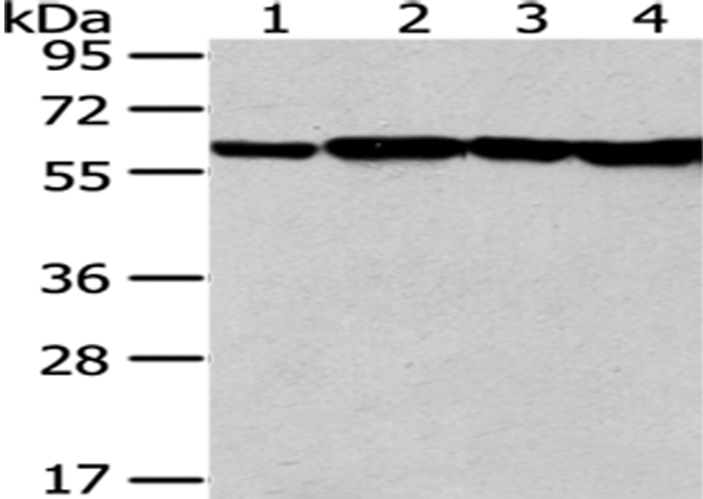 Rabbit Polyclonal Antibody to PKM