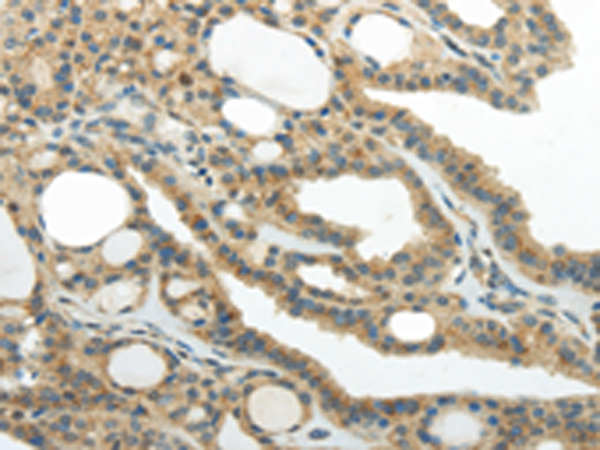 Rabbit Polyclonal Antibody to SMYD2