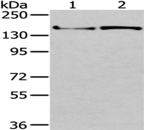 Rabbit Polyclonal Antibody to WNK3