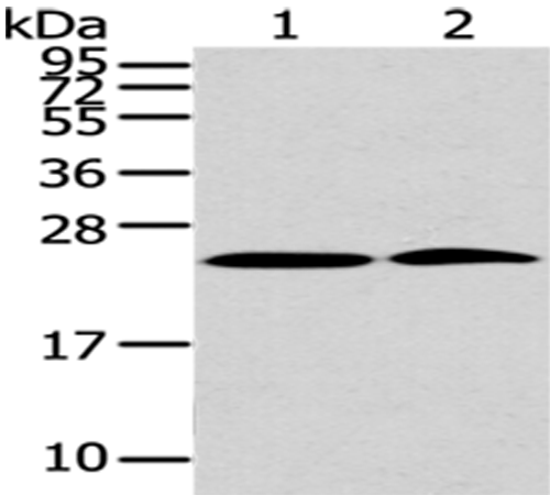 Rabbit Polyclonal Antibody to PDPN