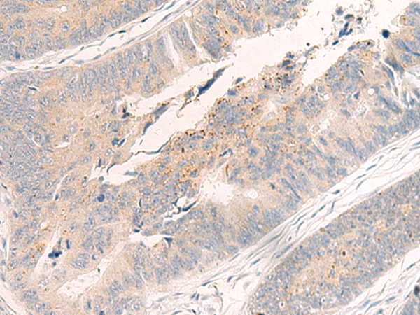 Rabbit Polyclonal Antibody to WNK4