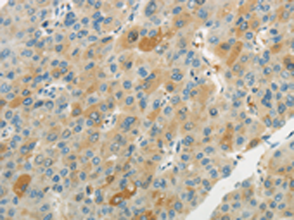 Rabbit Polyclonal Antibody to WNT2B