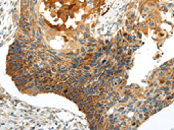 Rabbit Polyclonal Antibody to WNT8A