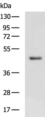 Rabbit Polyclonal Antibody to WNT5B