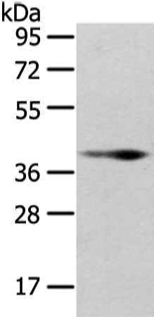 Rabbit Polyclonal Antibody to WNT10B