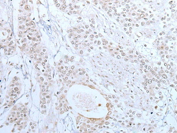 Rabbit Polyclonal Antibody to XAF1