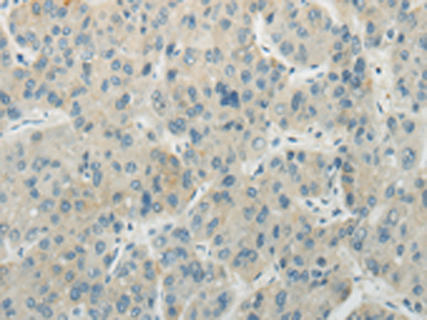 Rabbit Polyclonal Antibody to AICDA