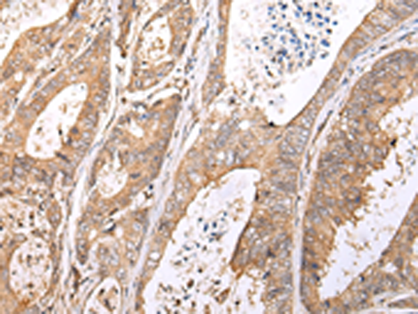 Rabbit Polyclonal Antibody to XKR7