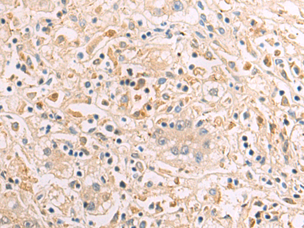 Rabbit Polyclonal Antibody to XKR4
