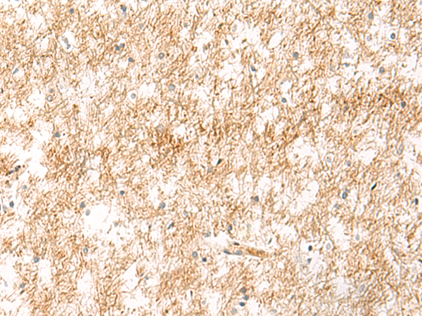 Rabbit Polyclonal Antibody to XPC