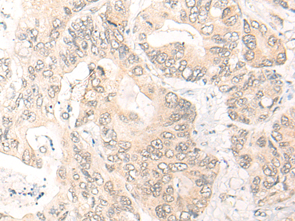 Rabbit Polyclonal Antibody to YAP1