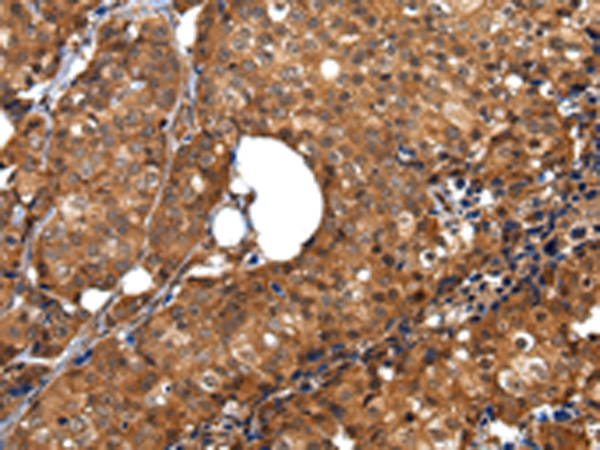 Rabbit Polyclonal Antibody to ZBTB2