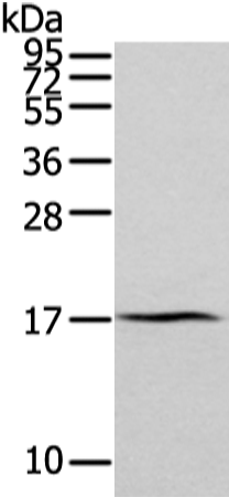 Rabbit Polyclonal Antibody to ZFAND2A