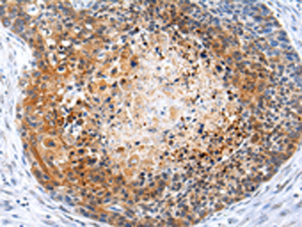 Rabbit Polyclonal Antibody to ZFP30