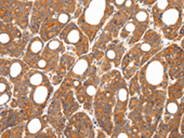 Rabbit Polyclonal Antibody to ZNF281