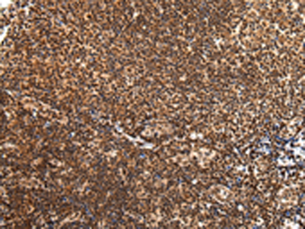 Rabbit Polyclonal Antibody to ZNF200