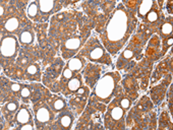 Rabbit Polyclonal Antibody to ARFGAP2