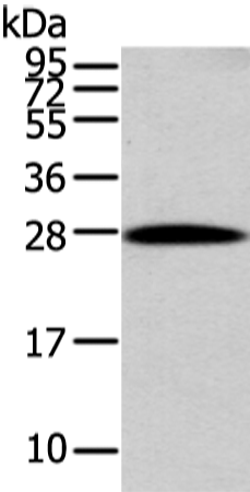 Rabbit Polyclonal Antibody to ZNF365