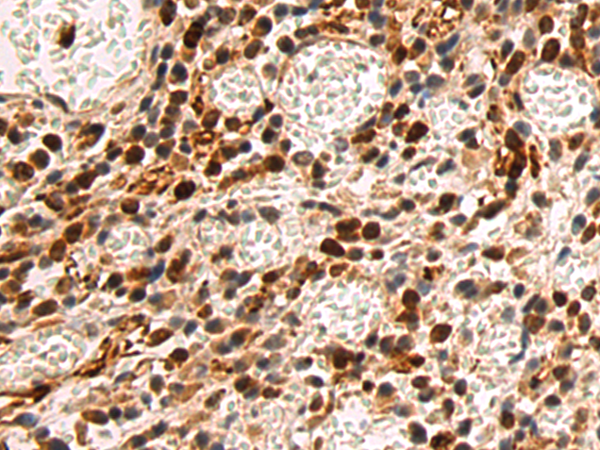 Rabbit Polyclonal Antibody to IKZF4