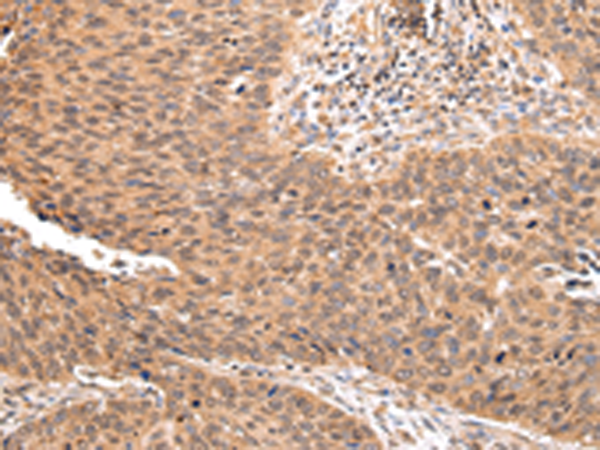 Rabbit Polyclonal Antibody to ZNF146